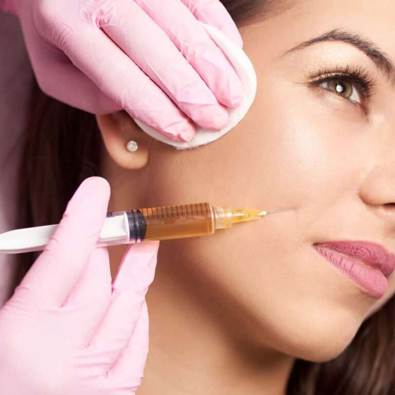 Fillers Treatment in peshawar and islamabad