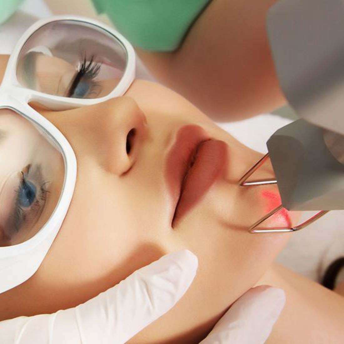 Laser Resurfacing