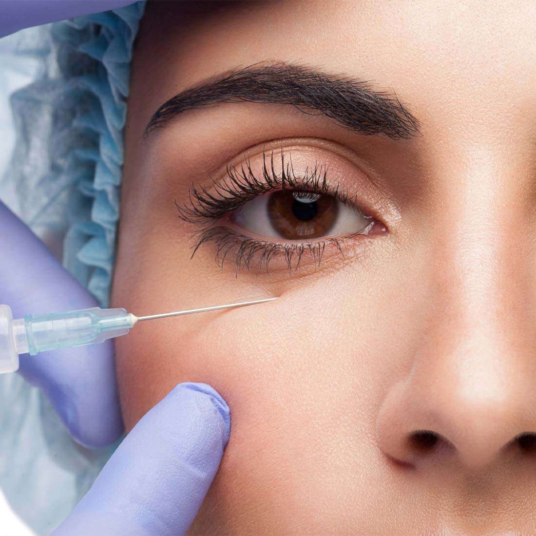 Undereye Enhancement In Peshawar