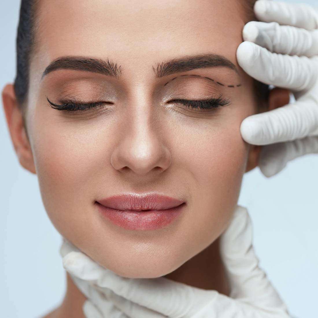 Upper Eyelid & Browlift