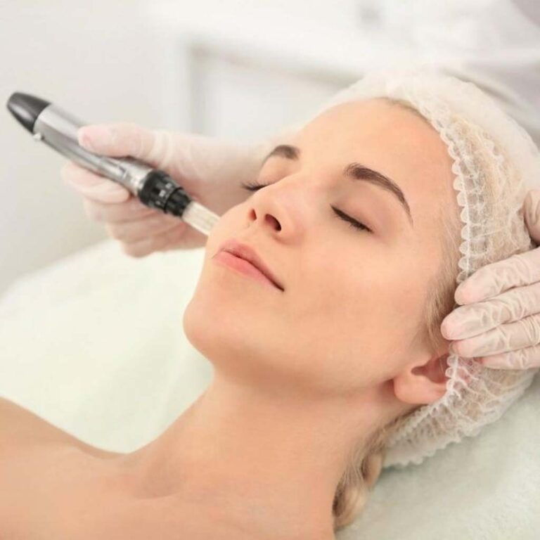 Skincare treatment in peshawar